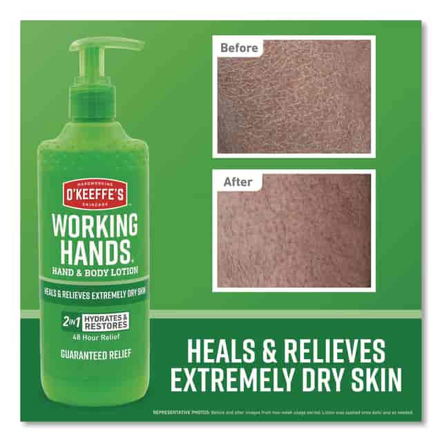 GOR115760 Product Image 7